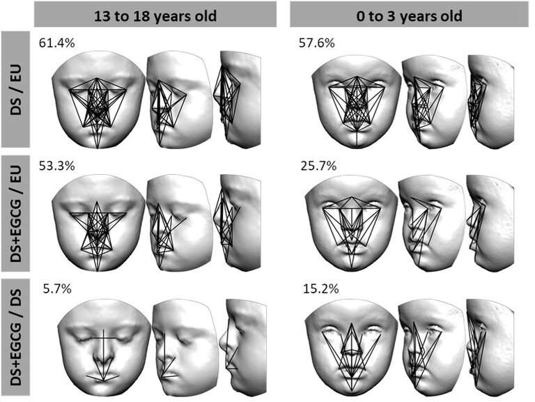 The observational study suggests that the green tea supplements only affect facial development when they are administered in the early stages of life. Credit: KU Leuven Green tea supplements modulate facial development of children with Down syndrome