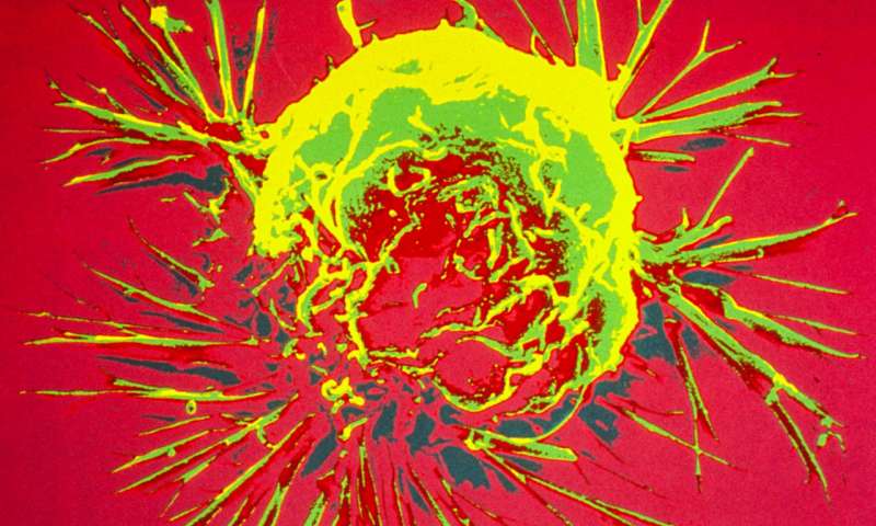 A breast cancer cell, photographed by a scanning electron microscope. Credit: Bruce Wetzel and Harry Schaefer, National Cancer Institute, National Institutes of Health breast cancer cell