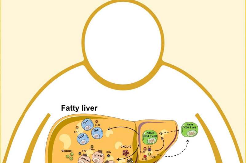 Obesity driven steatotic liver microenvironment through the activation of CXCR3 axis gives rise to a distinct population of inflammatory hepatic Th17 (ihTh17) cell subset, which preferentially utilizes the glycolytic pathway and PKM2 activity to fuel tissue inflammation and promote NAFLD progression. Credit: Cincinnati Children's Research reveals potential treatment to prevent obesity-driven liver damage