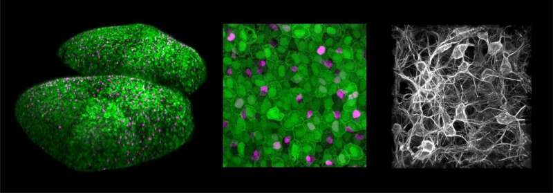 Left: Neural stem cells covering both cerebral hemispheres of an adult zebrafish.Center: Magnification enabling identification of stem cells that are quiescent (green only), activated (green and magenta), and in the process of differentiation (magenta only). Right: Neurons generated by these stem cells during adulthood. Credit: Nicolas Dray, Laure Mancini and Laure Bally-Cuif, Institut Pasteur Light shed on the coordination of neural stem cell activation