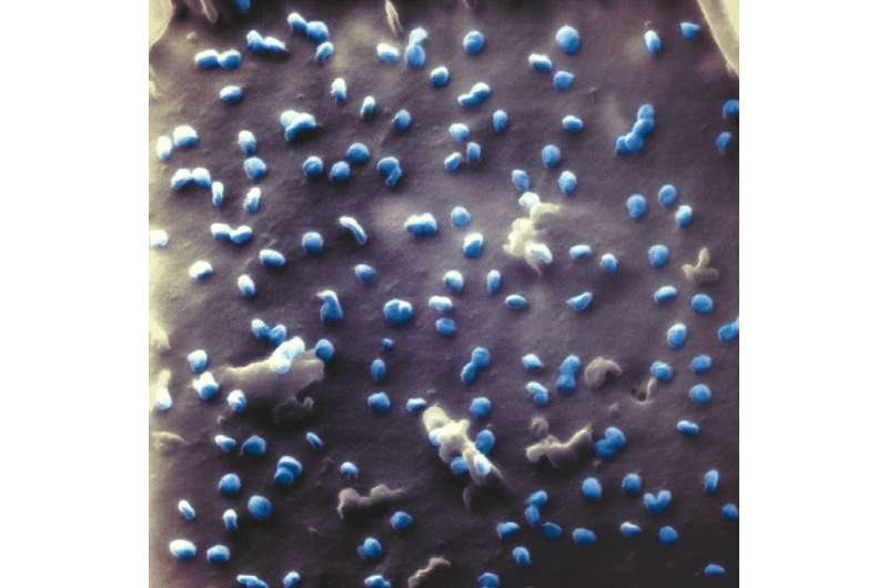 Coronaviruses (blue) exiting a kidney cell, images captured with a helium ion microscope. Credit: Bielefeld University/N. Frese How the cell binds the virus: SARS-CoV-2 under the helium ion microscope for the first time