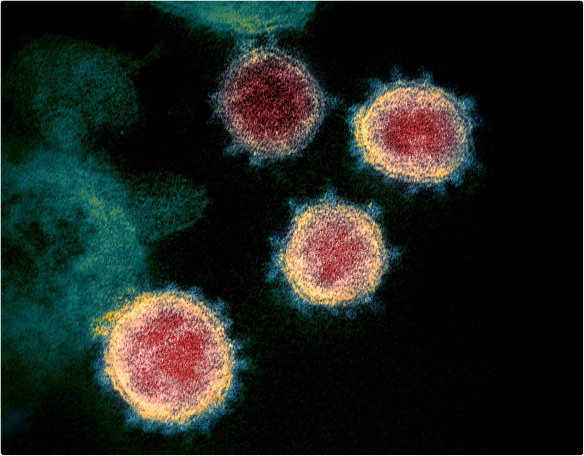 This transmission electron microscope image shows SARS-CoV-2—also known as 2019-nCoV, the virus that causes COVID-19—isolated from a patient in the U.S. Virus particles are shown emerging from the surface of cells cultured in the lab. The spikes on the outer edge of the virus particles give coronaviruses their name, crown-like. Image captured and colorized at NIAID