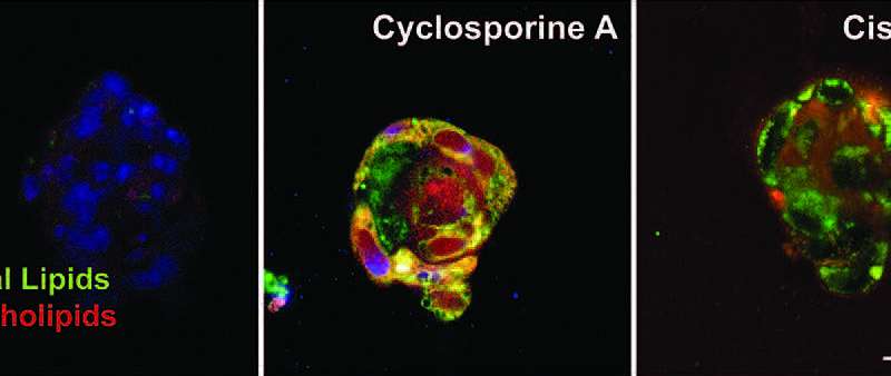Kidney-on-a-chip offers clues to prevent kidney damage from essential drugs