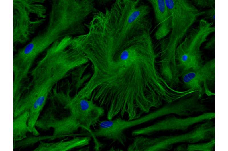Primary culture of astrocytes. Credit: © Inserm/Ruiz, Anne-Laure The key role of astrocytes in cognitive development
