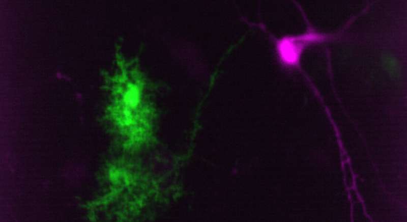 Medical cannabis can reduce essential tremor by turning on overlooked cells in central nervous system