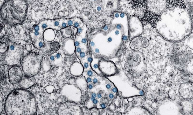 Credit: Unsplash/CC0 Public Domain virus