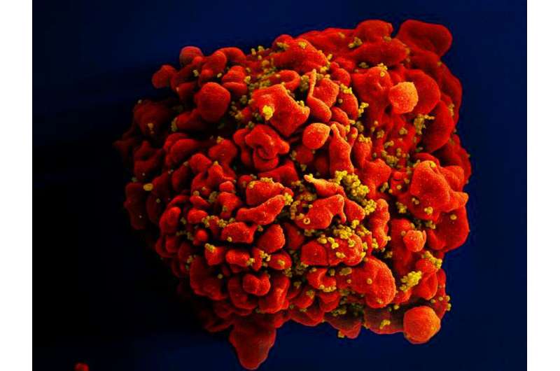 A T cell infected with HIV. Credit: National Institute of Allergy and Infectious Diseases (NIAID) Researchers devise more efficient, enduring CAR gene therapy to combat HIV
