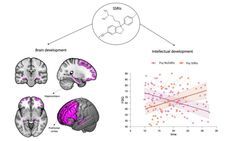 Effects of SSRIs on brain and intellectual development. on the left side: brain map showing regions of the brain protected by the prolonged administration of SSRIs comprising a network of prefrontal and limbic sructures. On the right side: plot displaying an increase in IQ scores in subjects treated with SSRIs as opposed to the IQ decrease in subjects not treated with SSRIs. Credit: University of Geneva Protecting the IQ of people at risk for psychosis