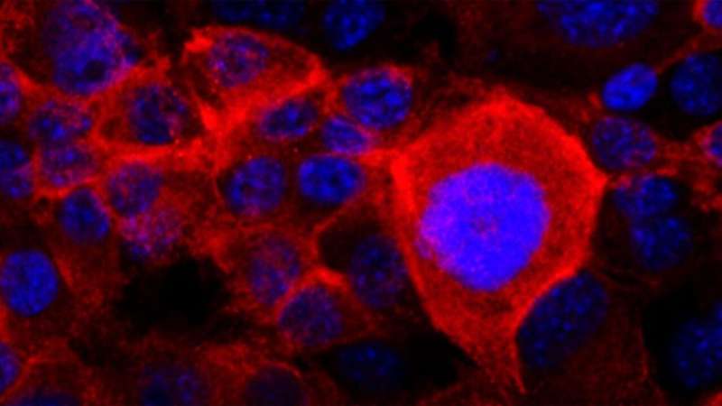 Most pancreatic cancer cells have mutations in the KRAS gene that allow unregulated growth. In this image, the mutant, cancer-causing version of the KRAS protein is stained red in pancreatic cancer cells. KRAS outlines the plasma membrane—the outer layer of the cell. Cell nuclei are stained blue. Cold Spring Harbor Laboratory researchers discovered a new mechanism that might explain how pancreatic cancer cells develop resistance to drug treatments that target the KRAS protein. Credit: Derek Cheng/Tuveson lab/CSHL How pancreatic cancer cells dodge drug treatments