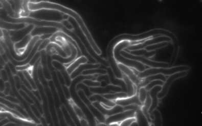 fluorescence image of bacteria attacked by bacterial toxin. Credit: Ethel Bayer-Santos Researchers discover a novel family of toxins used in bacterial competition