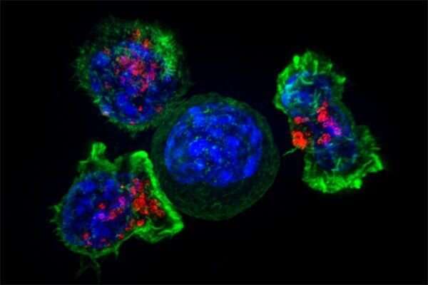 A group of killer T cells (green and red) surrounding a cancer cell (blue, center). Credit: NIH Next-generation T-cell therapeutics set sights on cancers, autoimmune disorders and more