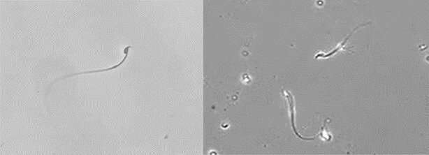 LEFT: Mouse sperm collected by a conventional cell sorter. Motility cannot be maintained and sperm cannot advance. Credit: Professor Toru Takeo A novel sperm selection technology to increase success rates of in vitro fertilization