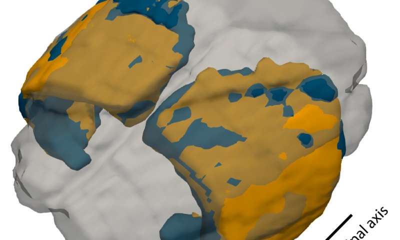 Superimposition of the cortex of a shrew imaged in winter (blue) and summer (orange) shows that cortex volume decreases in winter (mostly orange, indicating a larger summer cortex). Credit: Credit: Saikat Ray How the shrew brain adapts to winter