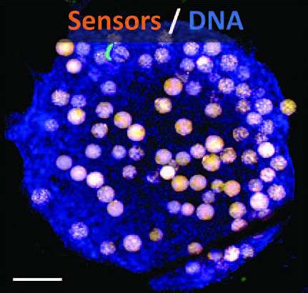 A human kidney spheroid with embedded oxygen sensors (orange). Credit: A. Cohen et al., Science Translational Medicine (2021) Kidney-on-a-chip offers clues to prevent kidney damage from essential drugs
