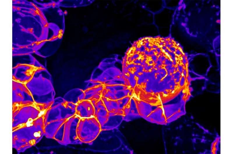 A neural stem cell and its progeny are seen under high-resolution imagery of their cell membranes in research at the University of Oregon. The stem cell is the large cell shown near the center with progeny from previous divisions, like grapes in a cluster, trailing to the left. The image is shown in false color. Credit: University of Oregon Oregon researchers find cell division machinery that makes brain cells