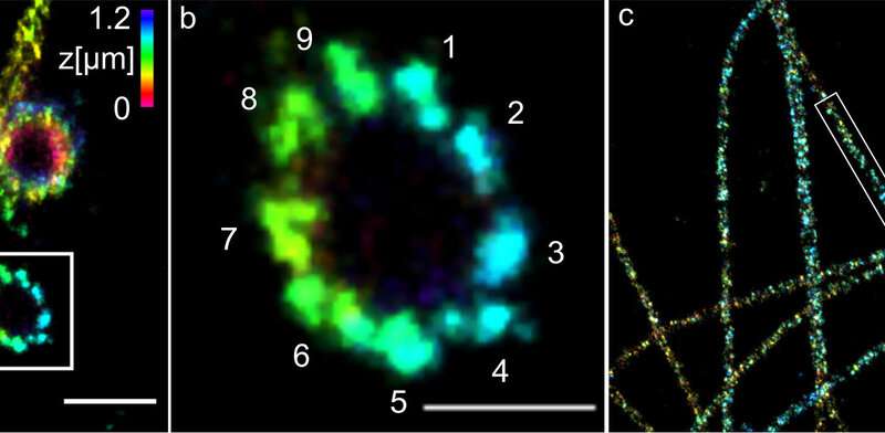 (a) Three-dimensional Ex-dSTORM of 3.2 times expanded centrioles. Measuring bar one micrometer. (b) The enlarged section of (a) shows the nine-fold symmetry of the percentile. Measuring bar 500 nanometers. (c) Three-dimensional Ex-dSTORM of 3.1-fold expanded tubulin filaments. Measuring bar two microns. (d) The magnification in (c) shows a tubulin filament; measuring bar 500 nanometers. (e) The cross-section of a tubulin filament shows its hollow structure. Measuring bar 200 nanometres. Credit: Team Markus Sauer / University of Wuerzburg Limitations of super-resolution microscopy overcome