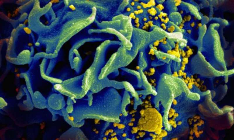 HIV