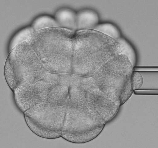 An ascidian consisting of 24 cells. The stiffness of the cells preparing for cell division is measured with a micropipette. Credit: Benoit Godard / IST Austria Relaxing cell divisions