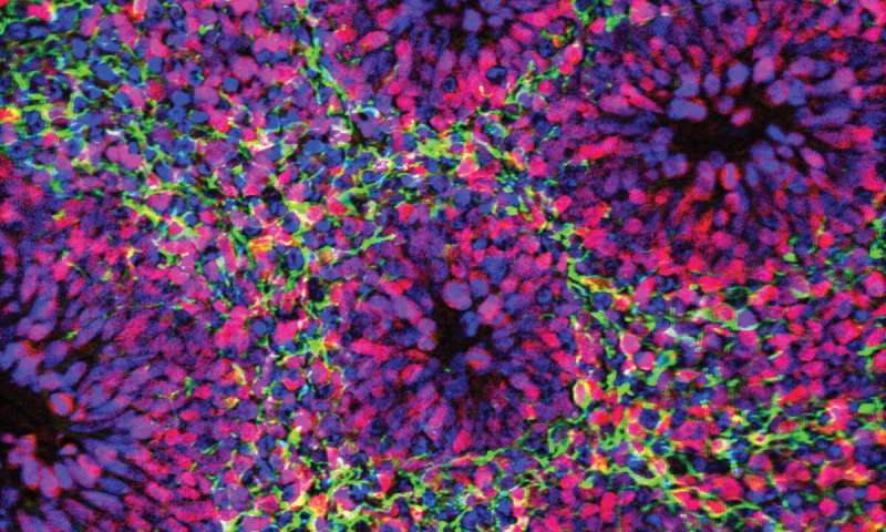 Organoids emerge as powerful tools for disease modeling and drug discovery