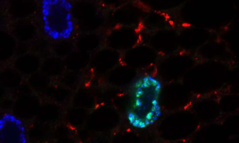 Cells expressing GFP-Sequoia-LIR mutant (green nuclei) activate autophagy (shown by red puncta). Credit: University of Warwick Warwick scientists discover how cells respond to fasting
