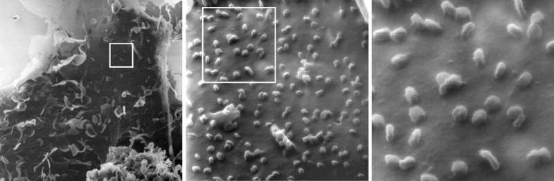 A kidney cell infected with SARS-CoV-2 under the helium ion microscope (sectional magnification from left to right, a single virus is about 100 nanometres in size): the images indicate that some coronaviruses only lie loosely on the cell as they exit, while other viruses are bound to the cell. Credit: Bielefeld University/N. Frese How the cell binds the virus: SARS-CoV-2 under the helium ion microscope for the first time