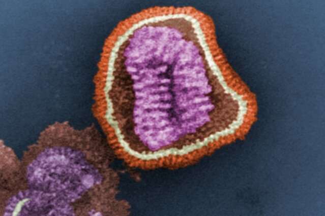 This digitally-colorized transmission electron microscopic image depicts the ultrastructural details of an influenza virus particle. Credit: CDC, Frederick Murphy influenza