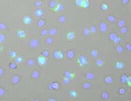 A keratinocyte cell line following infection with the Semliki Forest Virus (cell nuclei are shown in blue, and double-stranded RNA is stained in green). Credit: Stefan Bauernfried How epithelial cells ward off viruses