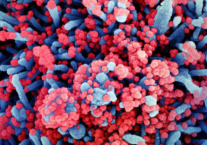 Colorized scanning electron micrograph of a cell (blue) heavily infected with SARS-CoV-2 virus particles (red), isolated from a patient sample. Image captured at the NIAID Integrated Research Facility (IRF) in Fort Detrick, Maryland. Credit: NIAID SARS-CoV-2 , COVID-19