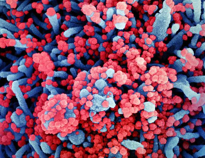 Colorized scanning electron micrograph of a cell (blue) heavily infected with SARS-CoV-2 virus particles (red), isolated from a patient sample. Image captured at the NIAID Integrated Research Facility (IRF) in Fort Detrick, Maryland. Credit: NIAID SARS-CoV-2 , COVID-19