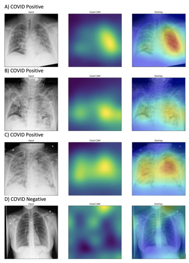 Grad-CAM Heat Maps Positive COVID-19 Prediction