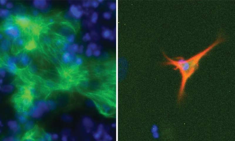 The scientists used EpiMogrify to predict molecules needed to control the cell state and fate of cardiac muscle cells (left) and astrocytes (right). Credit: Joseph Chen, Monash University Computational approach shows promise for optimising culture conditions required for cell therapy