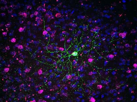 A specific type of interneuron (green) is imaged in the visual cortex of marmoset. Credit: Kirsten Levandowski and Heather Zaniewski New neuron type discovered only in primate brains