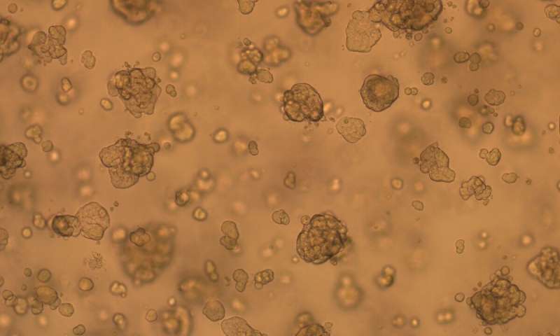 Organoids emerge as powerful tools for disease modeling and drug discovery