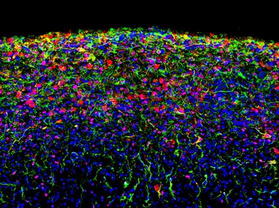 A brain organoid derived from a human induced pluripotent stem cell line and grown in culture for 180 days shows a high level of cell-type diversity, including radial glial cells (magenta) and astrocytes (green and red). Cell nuclei are labelled in blue. Credit: Silvia Velasco, Paola Arlotta laboratory, Harvard University and Broad Institute Organoids emerge as powerful tools for disease modeling and drug discovery