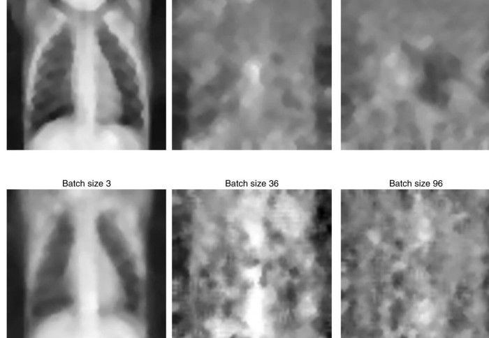Image of six chest x-rays