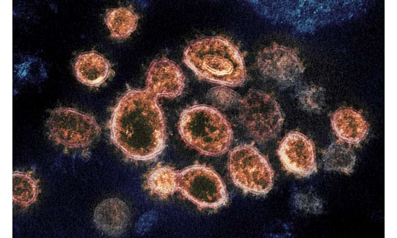 This 2020 electron microscope image provided by the National Institute of Allergy and Infectious Diseases - Rocky Mountain Laboratories shows SARS-CoV-2 virus particles which cause COVID-19, isolated from a patient in the U.S., emerging from the surface of cells cultured in a lab. According to two new studies released on Tuesday, Dec. 22, 2020, people who have antibodies from infection with the coronavirus seem less likely to get a second infection for several months and maybe longer. (NIAID-RML via AP) Studies find having COVID-19 may protect against reinfection