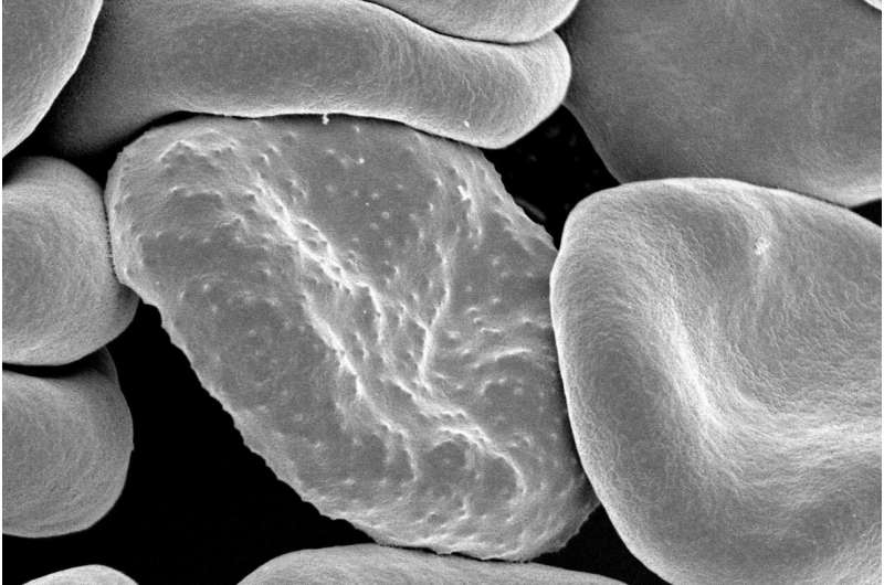 Plasmodium falciparum, the parasite that causes malaria in humans, forms protrusions called “knobs” on the surface of its host red blood cell which enable it to avoid destruction and cause inflammation. Credit: National Institutes of Health New approach to DNA research could be key to solving mysteries of deadly diseases