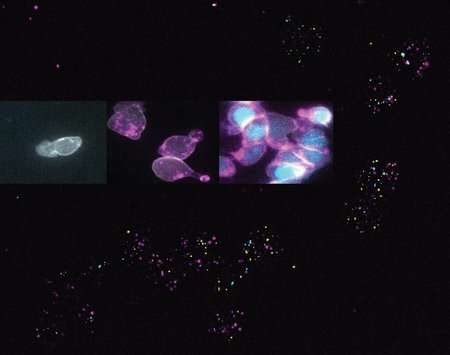 Transforming progenitor cells into committed T-cell precursors in real time. Inset: Live imaging of a clone of future T cells, from progenitor stage (left) to commitment (right) in 3 days (courtesy, Mary A. Yui). Background: field of cells corresponding to a mixture of these stages, all processed to show individual molecules of RNA encoding key regulatory proteins. Runx1 (cyan dots) is expressed at similar levels in cells at early, middle, and late stages alike (courtesy, Wen Zhou). Credit: B. Shin Surprising behavior of transcription factors challenges theories of gene regulation