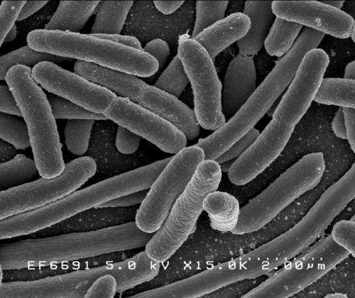 Escherichia coli. Credit: Rocky Mountain Laboratories, NIAID, NIH e coli
