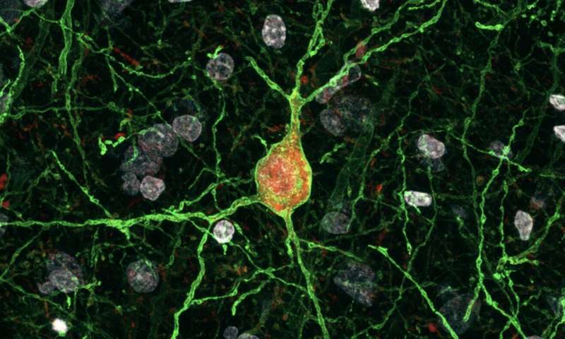 High-resolution confocal image of a fast-spiking interneuron in the cortex of a macaque. As a consequence of its exposure to the AAV-E2-GFP described in the study, this neuron expresses a green viral reporter that fills his membrane, revealing its proximal morphology. The red signal confirms the presence of parvalbumin, a gene expressed exclusively in this subtype of interneurons. The ability to target and manipulate specific types of neurons is crucial for understanding brain function and develop novel therapeutic approaches to treat CNS disorders. The work from the Dimidschstein laboratory describes a series of novel gene regulatory sequences that restrict expression of viral transgenes to specific interneuron subtypes, allowing for precise visualization and manipulation of their neuronal activity from mice to humans. Credit: Jessica Lin. A new strategy for the viral manipulation of interneurons in mice and other mammals
