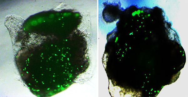 brain and lung organoids
