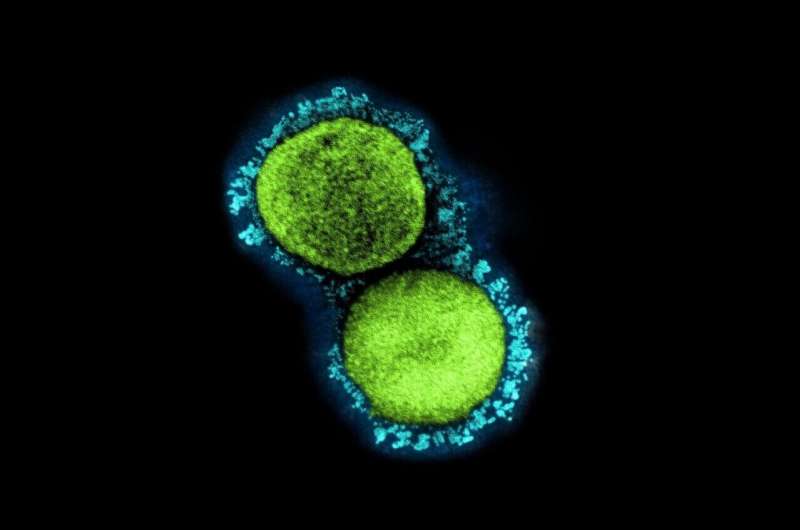 A transmission electron micrograph of SARS-CoV-2 virus particles (UK B.1.1.7 variant), isolated from a patient sample and cultivated in cell culture. Credit: NIAID COVID-19