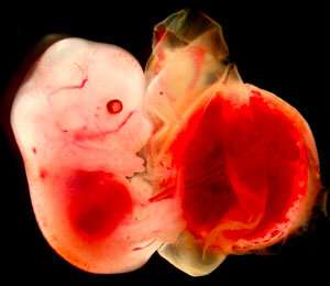 Figure 1: A mouse embryo (left) produced by somatic cell nuclear transfer (SCNT) attached to a normalized placenta (right). RIKEN researchers have discovered why SCNT produces large placentas. Credit: RIKEN BioResource Research Center Cause of oversized placentas in cloning found after two decades