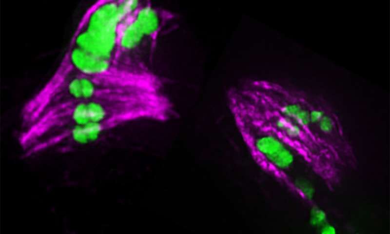 Fluorescent image shows chromosomes (green) segregating in two developing eggs. In each egg, one chromosome (the largest green one) has too many crossovers and is having problems segregating. The image was taken on a deconvolution fluorescent microscope. Credit: Diana Libuda Chromosome defects seen from over-exchange of DNA in sperm and eggs