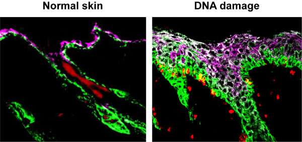 An image of skin cells before and after DNA damage added through chemotherapeutic agents shows stem cell overgrowth. Credit: Seldin Chemotherapeutic agents can have the opposite effect of tissue overgrowth in normal tissues