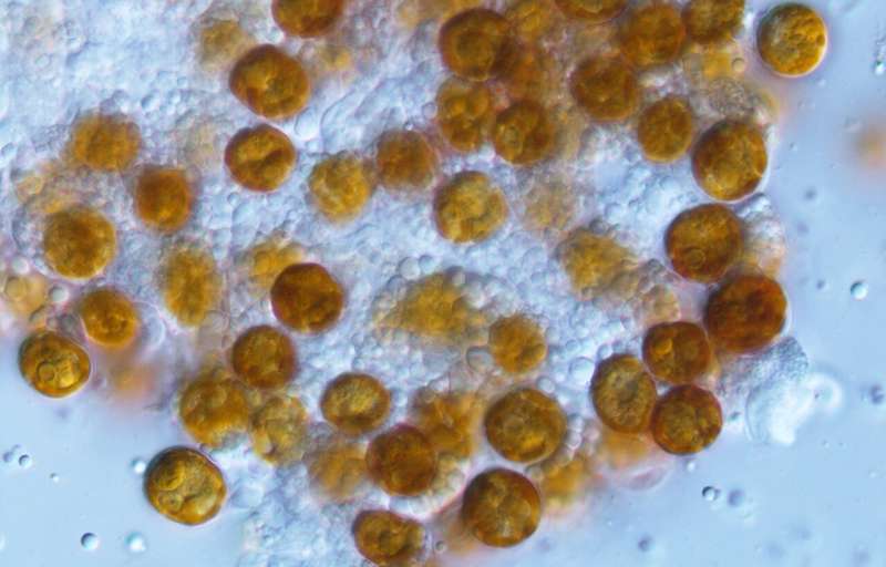 "Yellow cells" of the symbiotic algae, Philozoon collosum, isolated from the soft coral, Capnella gaboensis, collected off the east coast of southern Australia. Credit: Matthew R. Nitschke Scientists resurrect 'forgotten' genus of algae living in marine animals