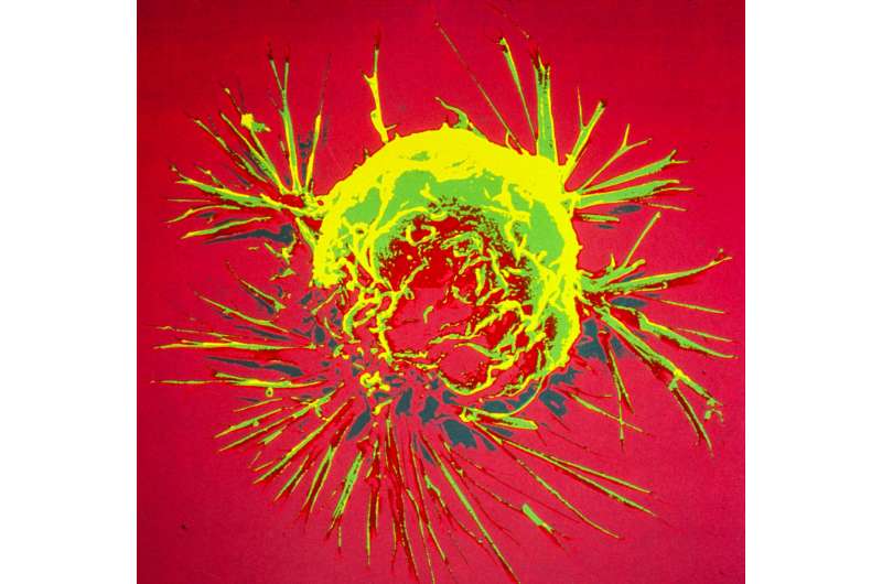 A breast cancer cell, photographed by a scanning electron microscope. Credit: Bruce Wetzel and Harry Schaefer, National Cancer Institute, National Institutes of Health breast cancer cell