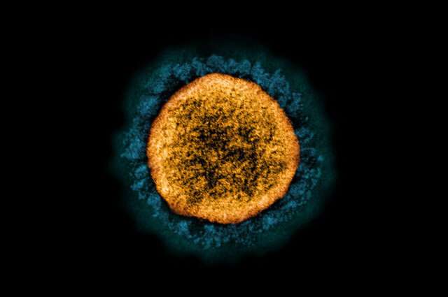 “A virus will make hundreds to thousands of copies of itself every time it is in a cell,” says Marta Gaglia. “The chances of getting a mutant is high just because there’s so many replications happening.” Here, the Alpha variant virus. Credit: NIAID How viruses mutate and create new variants