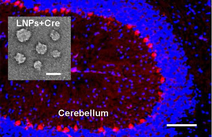 A successful transfer of Cre-recombinase packaged in an NT-lipidoid-doped lipid nanoparticle is demonstated when the Cre-recombinase activates expression of the tdTomato fluorescent protein in the cells of the mutant mice. Transfected neurons located throughout the brain (cerebellum shown here) light up in red (scale bar 100μm)Inset: TEM image of lipid nanoparticles containing Cre-recombinase (scale bar 0.1μm). Credit: Qiaobing Xu, Tufts University Novel drug delivery particles use neurotransmitters as a 'passport' into the brain
