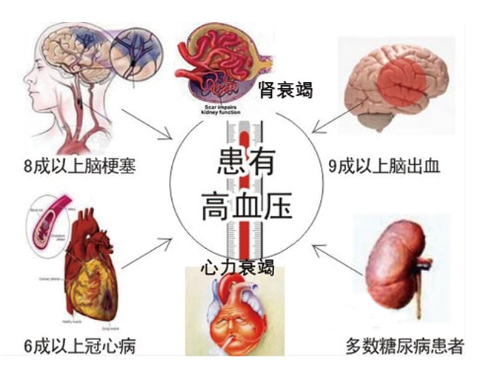 防控高血压:建立良好的饮食和健康生活方式